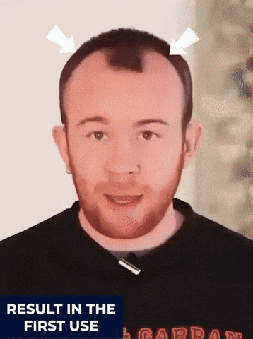Customer sharing his hairline experience