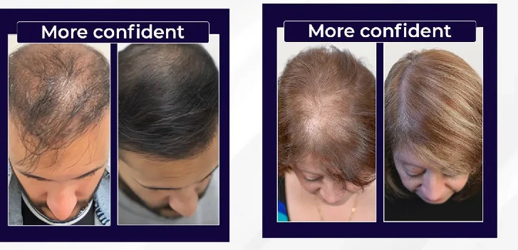 Men and women showing fuller-looking hair